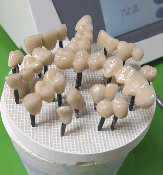 Протез зубной техник