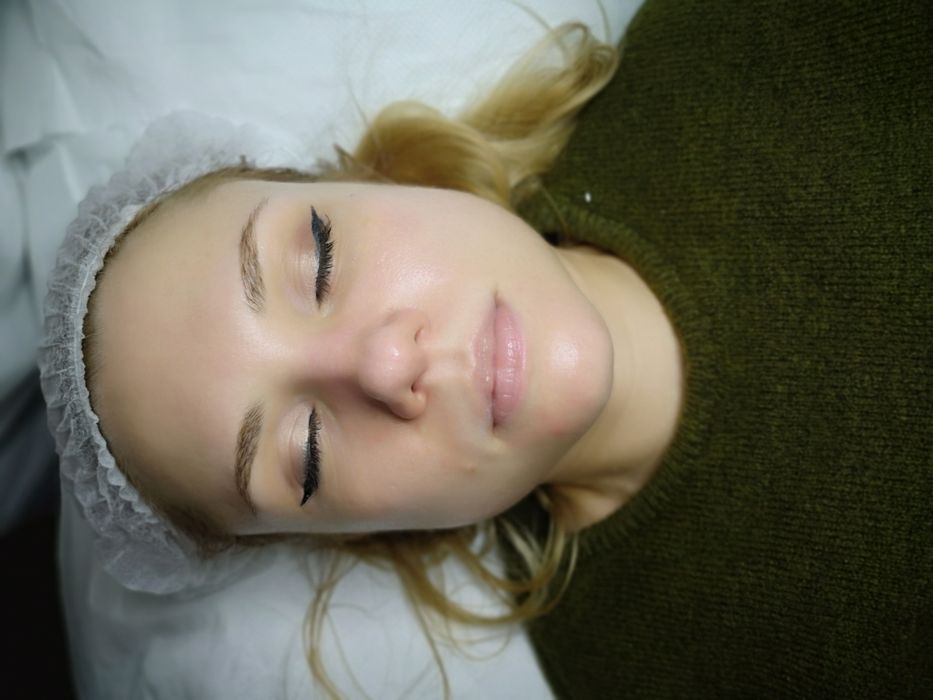 HydraFacial profesional – curățare profundă și hidratare intensă