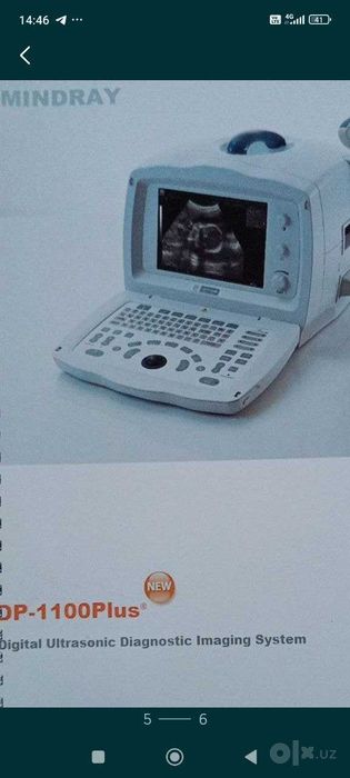 УЗД аппарат   Mindray DP1100