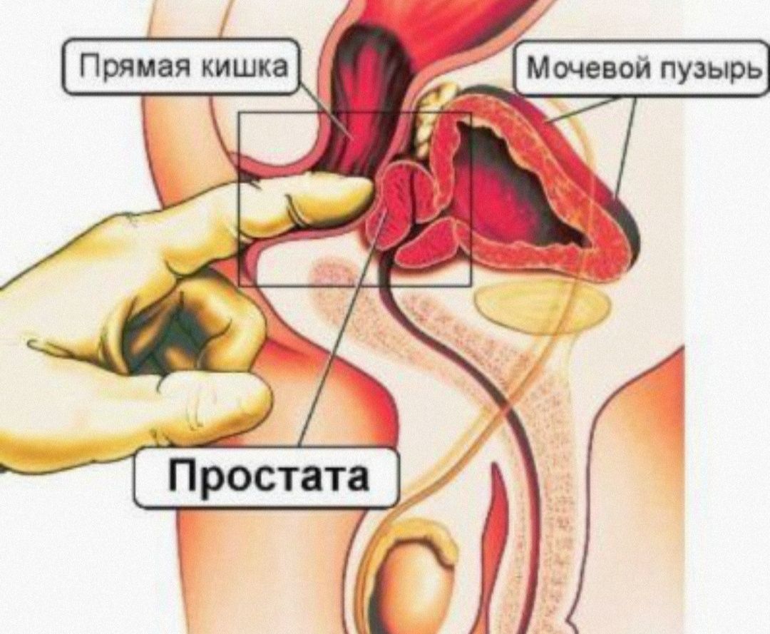 Урологический массаж простаты и консультация уролога - Медицинские услуги  Шымкент на Olx