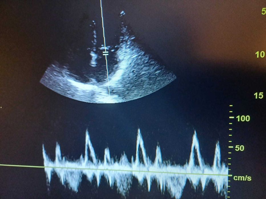 Ecograf stationar GE Logiq F6 cu trei sonde in stare excelenta