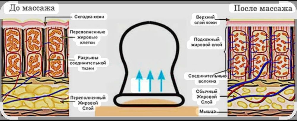 Теплавизар находка утечек тепло в доме