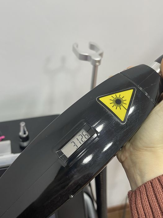 Лазерный аппарат для удаления тату