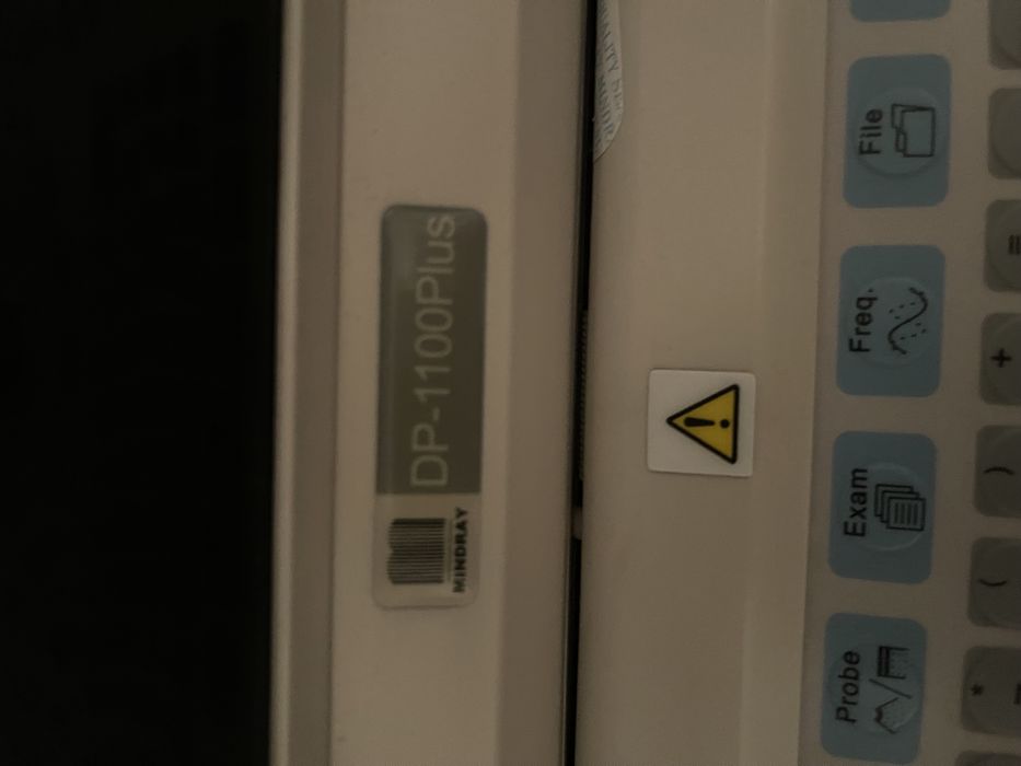 Узи аппарат