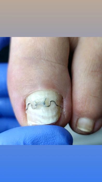 Ищу моделей на коррекционную систему