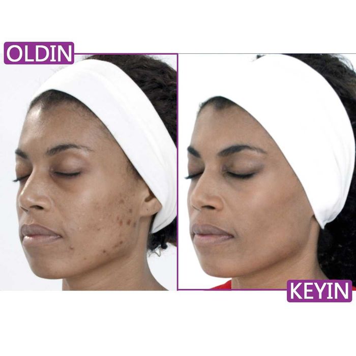 Ellezza — гель для лица с экстрактом улитки против морщин и пятен