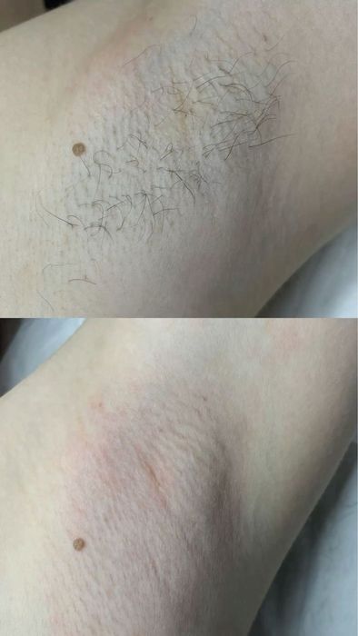 Ламинация и депиляция