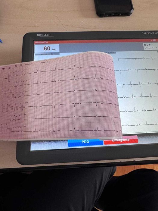 Electrocardiograf Schiller Cardiovit MS-2010