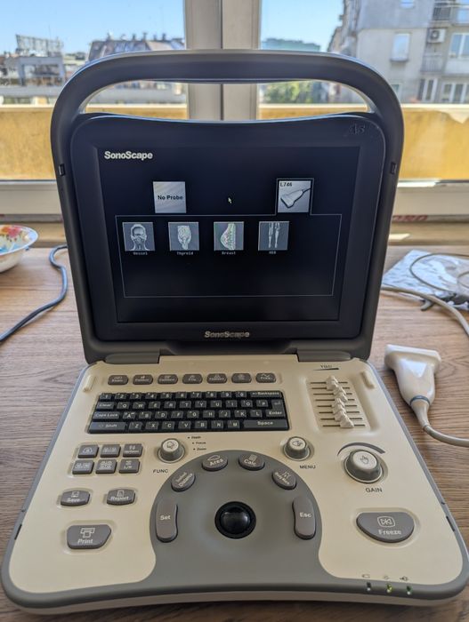 SonoScape A5 – Преносим ехограф с трансдюсер