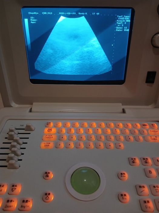 Продаётся Узи аппарат