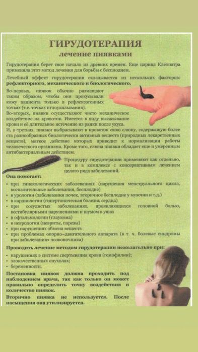 Лечение пиявками Сулikпен емдеу