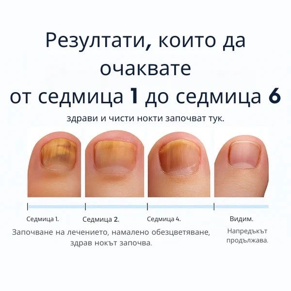 Лепенки против гъбички по ноктите