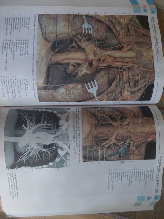 Atlas de Anatomie Umana