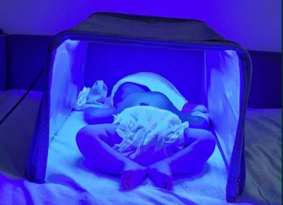 Лампа от желтухи