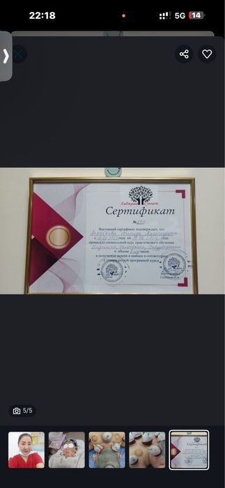 Пиявки Астана - Гирудотерапия