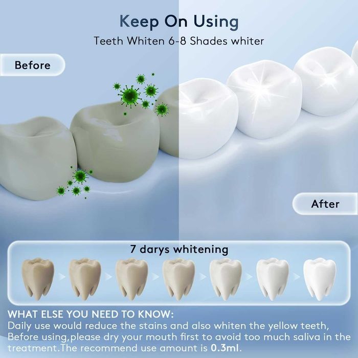 Комплект за избелване на зъби с LED светлини