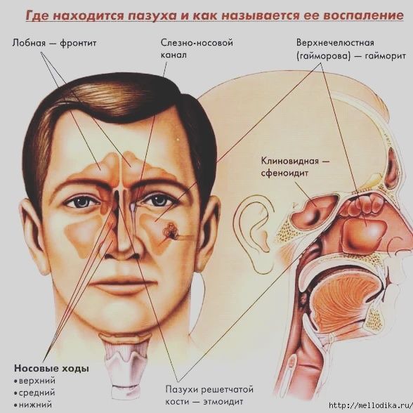 Гайморит/синусит емдеу