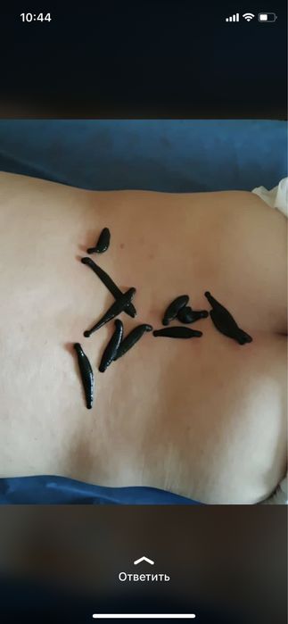 Банки вакуумные