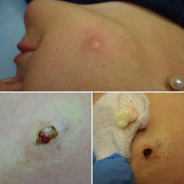 Врач-хирург на выезд