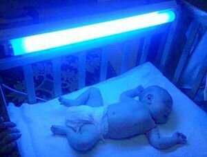 Аренда фотоламп от желтушки и билитеста в Актобе