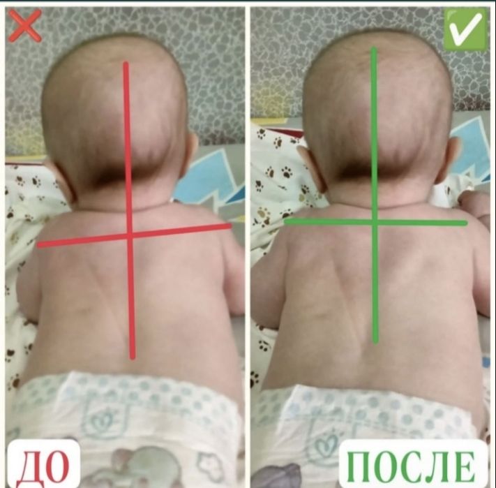 Детский массаж Шымкент