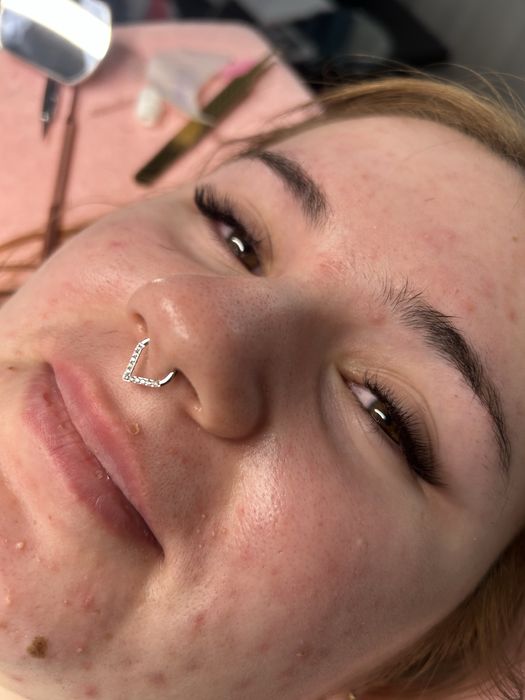 Aplic extensii gene Pitesti