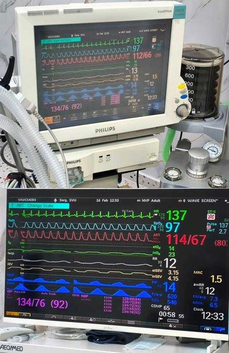 Монитор пациента Philips IntelliVue MP70 anesthesia