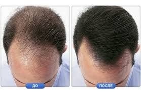 Сийрак сочларни қалинлаштириш Toppik caboki dexe syinte