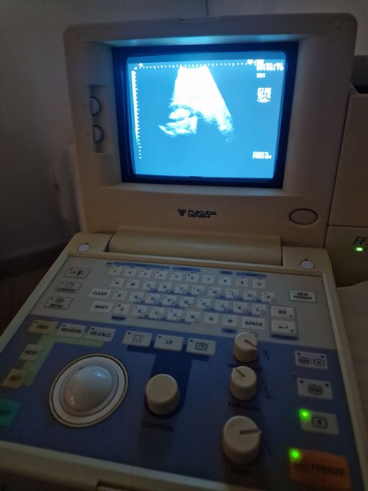 Ecograf portabil Fukuda Denshi FF Sonic UF-4100 – 2 sonde