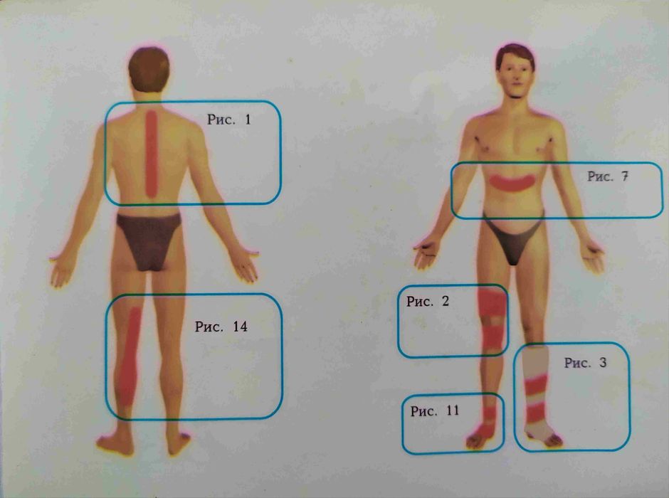Прибор оздоровительный.