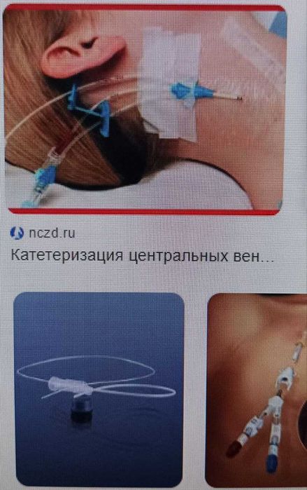 Анестезиолог-реаниматолог хизмати,беморларга уй шароитида хизмат кур.