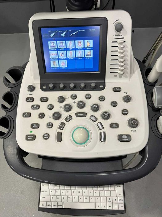 Универсальный УЗИ-аппарат SonoScape S20EXP