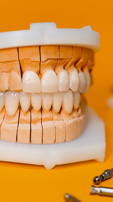 Диоксид-циркония  Керамика  коронки и протезирование