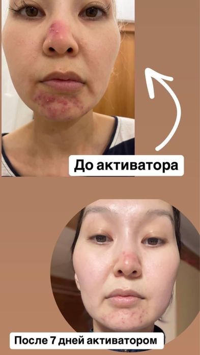 активатор клеток