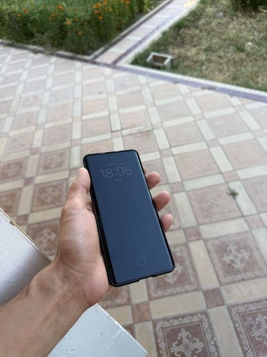 Telefon nomi: Redmi note 15 
Holati yangi 20 kun ishlatilgan
Karopkasi