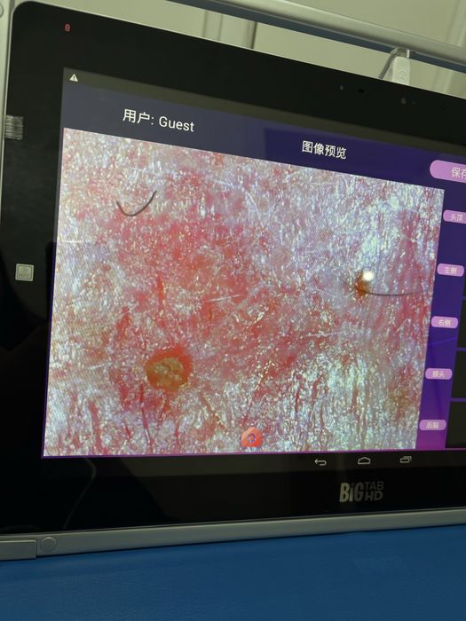 Аппарат для диагностики волос и лица