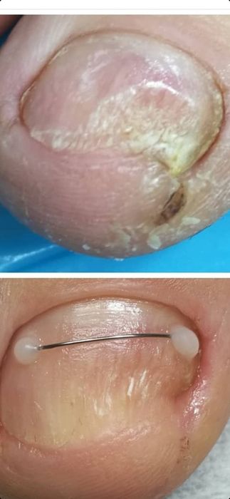 Мужской маникюр педикюр