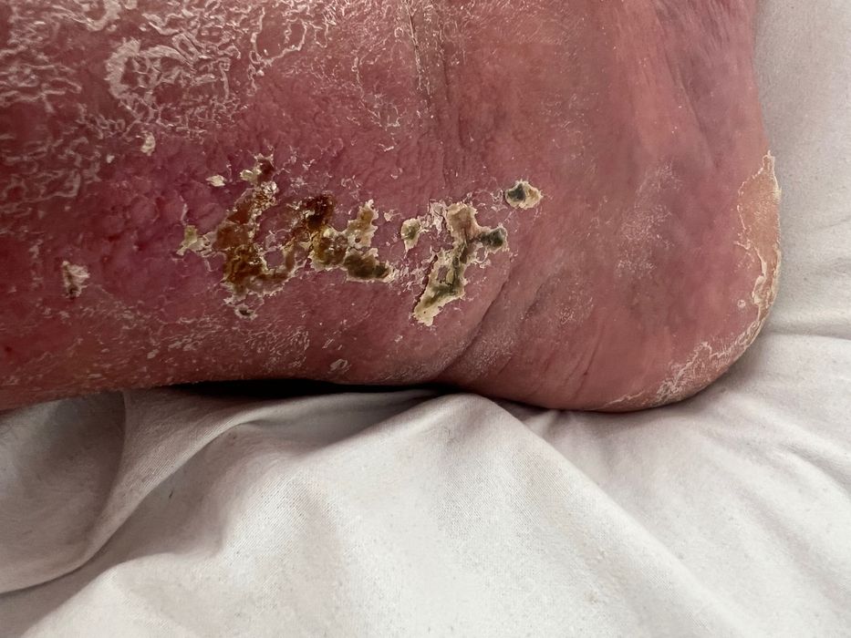 Voi vinde o brichetă de benzină Zippo cu o copertă.