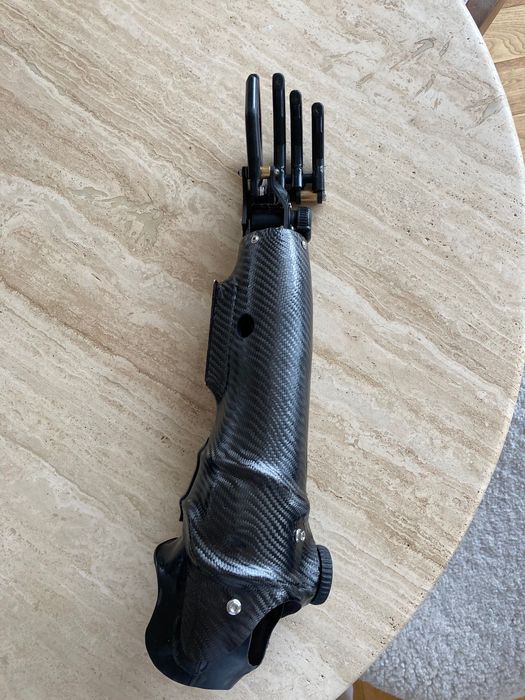 Протеза за ръка (миоелектрична)