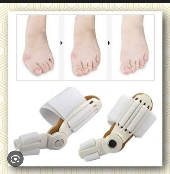 Фиксатор для косточек