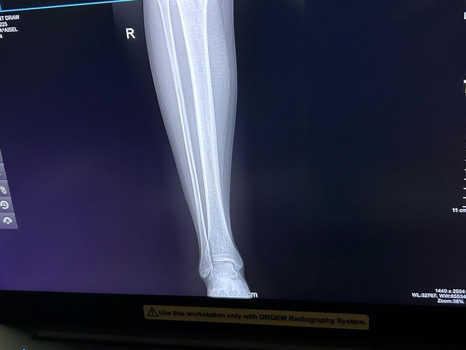 Сынықшы Костоправ