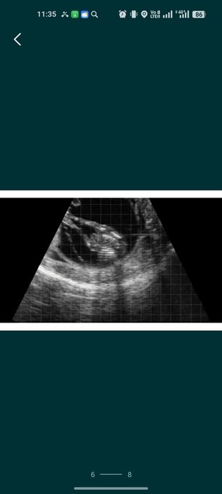 УЗИ для животных лошадей и коровы