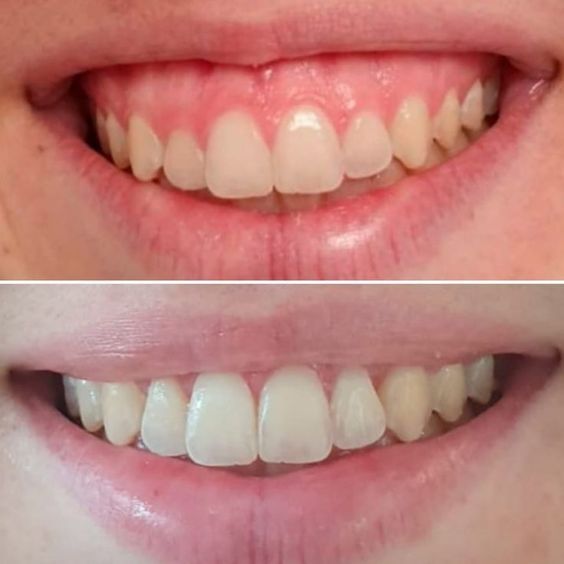 Эстетика красота