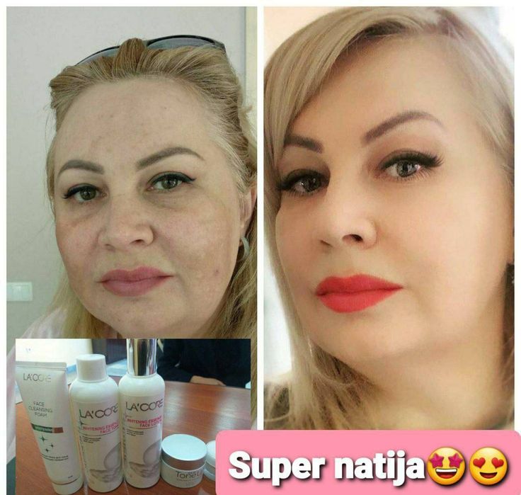 Oqartiruvchi krem. Koreya mahsuloti original. Kremi toza yuzga masajni