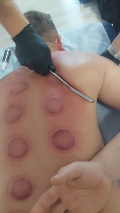 Chiropractică, Terapia Trigger Point ,IASM și Complementară