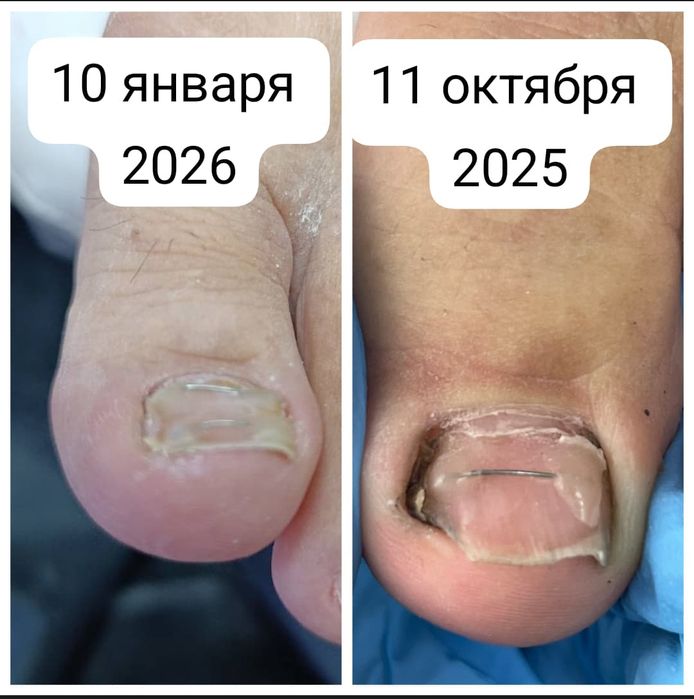 Подолог, Маникюр, Педикюр