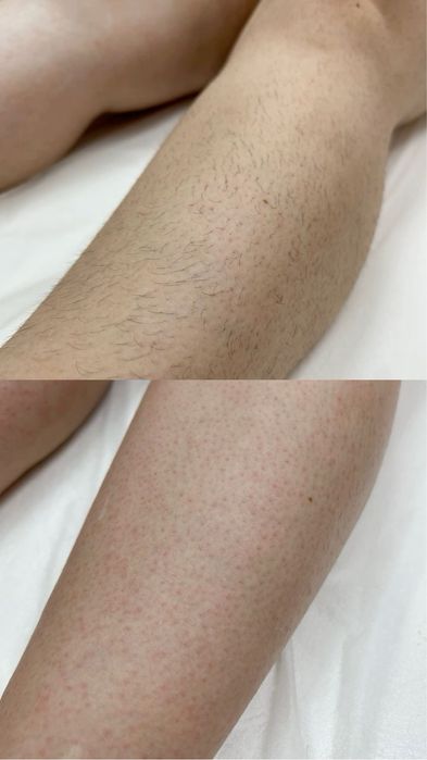 Обучение шугаринг