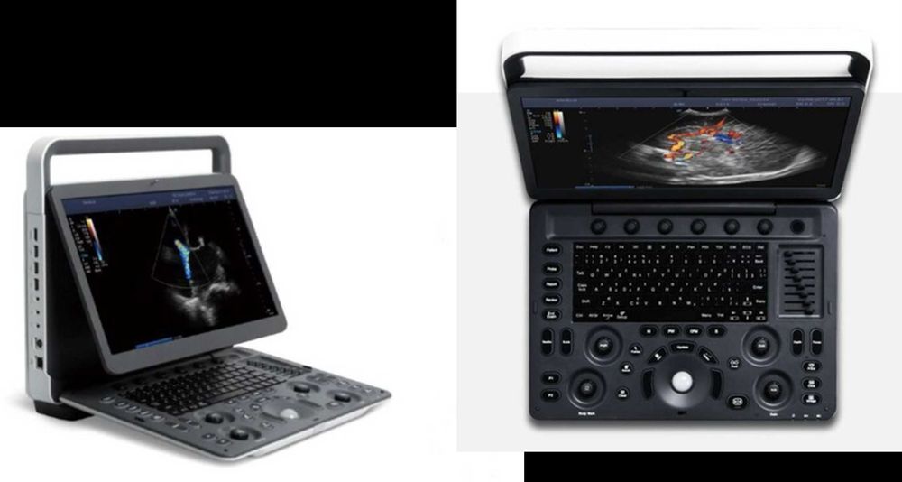 SonoScape узи портативный E3