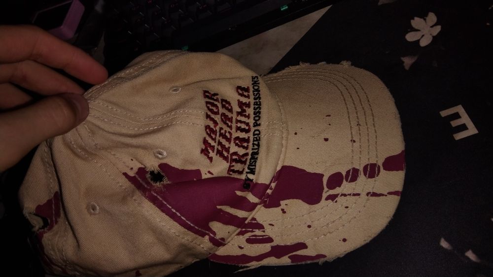 Archive cap Major head trauma