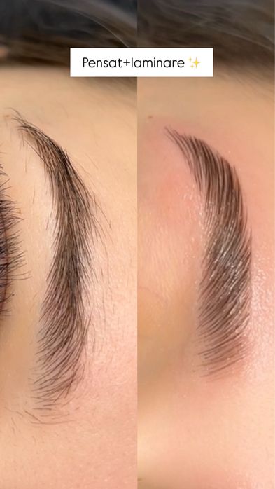 Extensii gene/Laminare